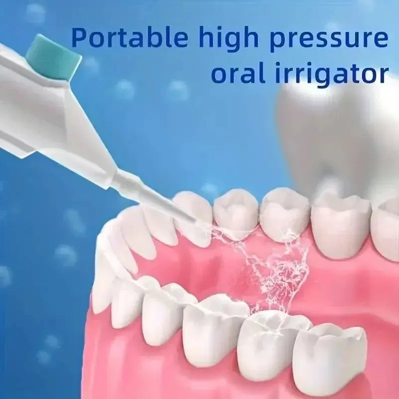 Household High Pressure Oral Irrigator Portable Teeth Clean Water Dental Floss Manual High Pressure Water Toothpick - Fun Tech and Gadgets